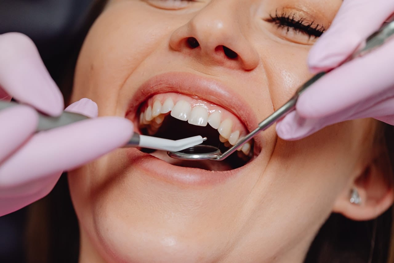 Gummy Smile Treatment Melbourne