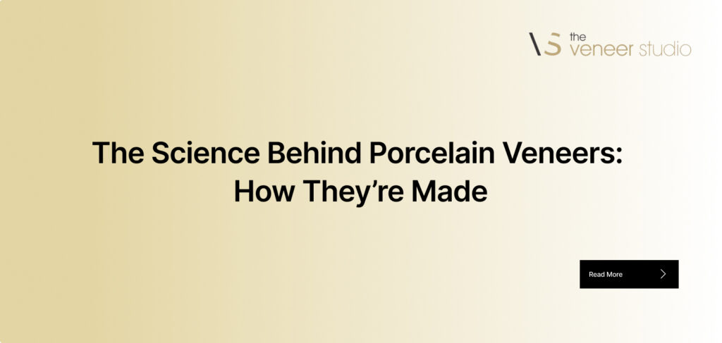 How are porcelain veneers made