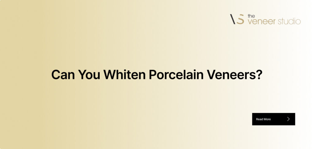 Can You Whiten Porcelain Veneers