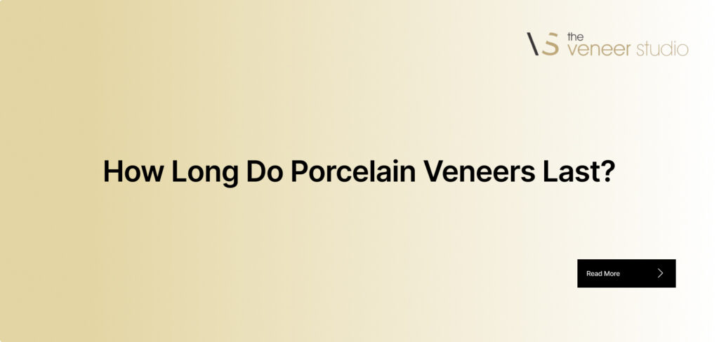 How Long Do Porcelain Veneers Last