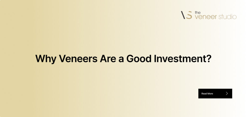 Why Veneers Are a Good Investment