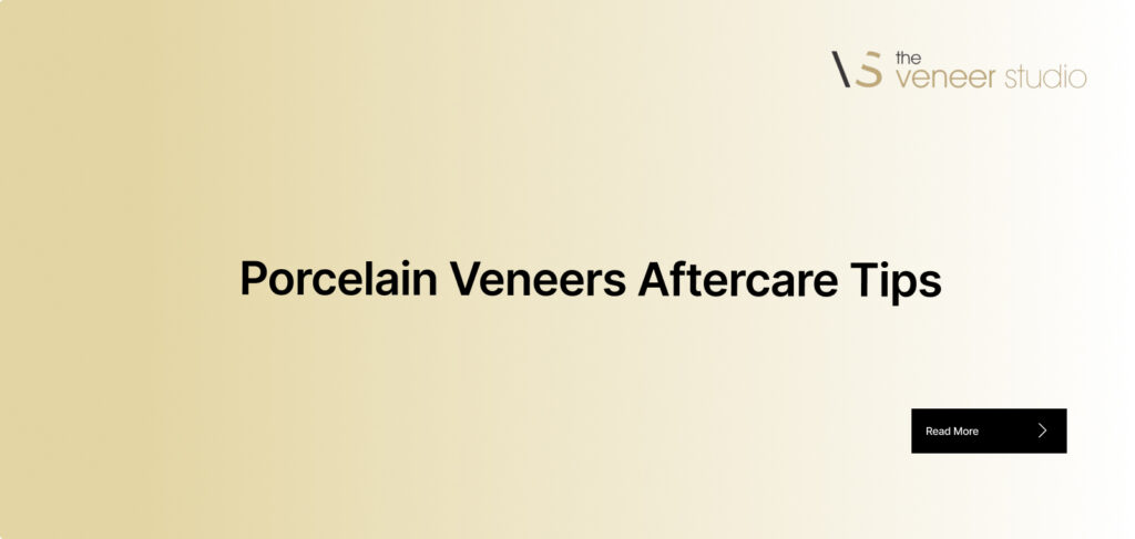 Porcelain Veneers Aftercare Tips