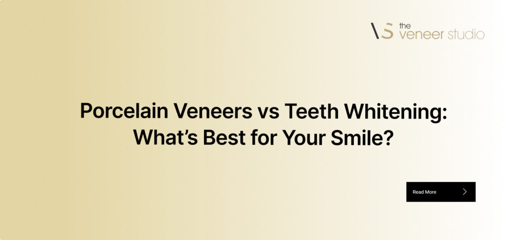 Porcelain Veneers vs Teeth Whitening