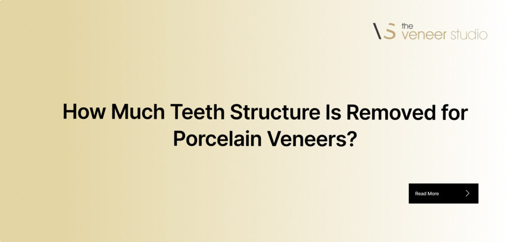 How Much Teeth Structure Is Removed for Porcelain Veneers