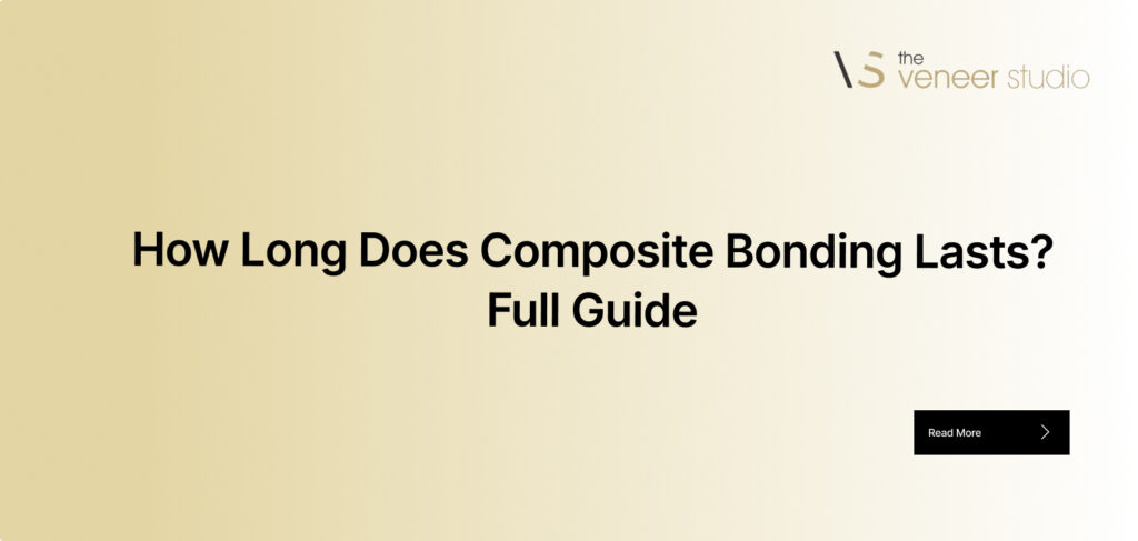 how long does composite bonding last