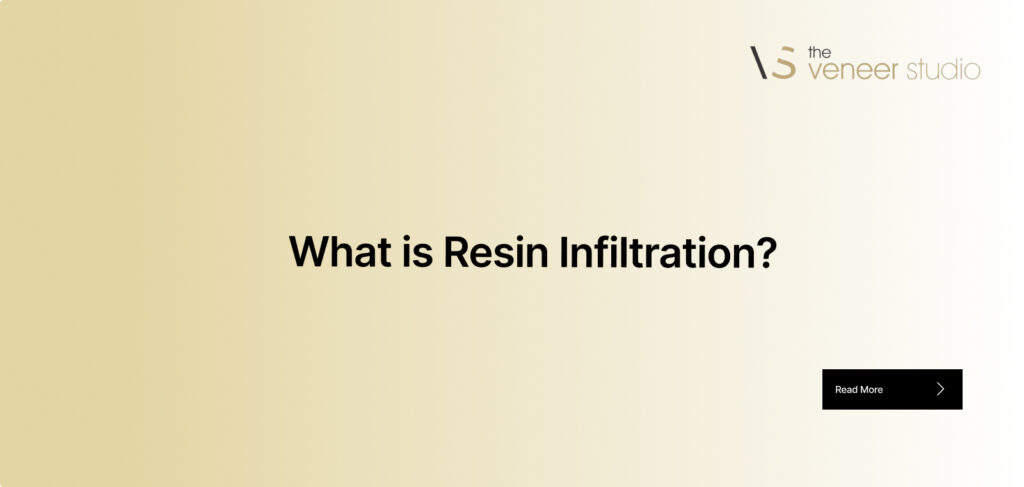 What is Resin Infiltration