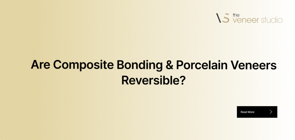 Are Composite Bonding & Porcelain Veneers Reversible